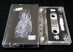 16XXX / Traumatic Brain Injury split CS $4