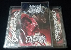 Sarcoptes / Human Pancake split CS $4