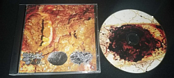 Stercoraceous Copremesis Rhinorrhea / Sicuprscoabaiw/ Epiploenterocele Pusliquid Wormchunk split CDR $5